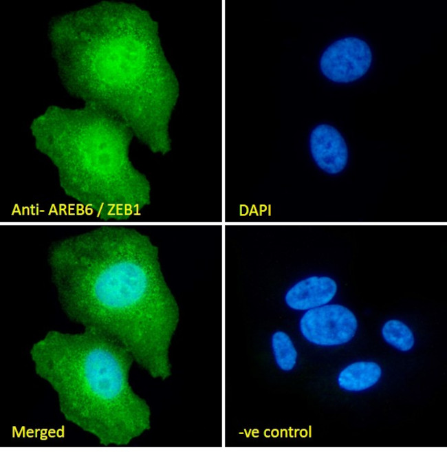 ZEB1 Antibody in Immunocytochemistry (ICC/IF)