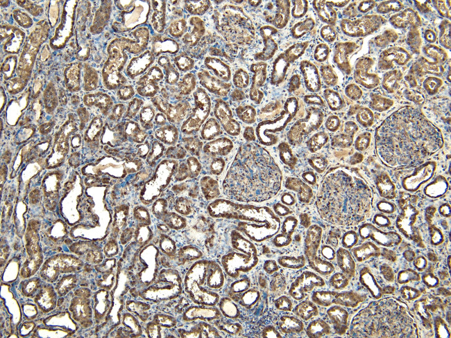 EWSR1 Antibody in Immunohistochemistry (Paraffin) (IHC (P))