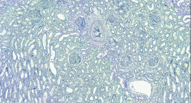 EWSR1 Antibody in Immunohistochemistry (Paraffin) (IHC (P))