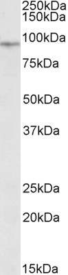 EWSR1 Antibody in Western Blot (WB)