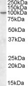 CENTG1 Antibody in Western Blot (WB)