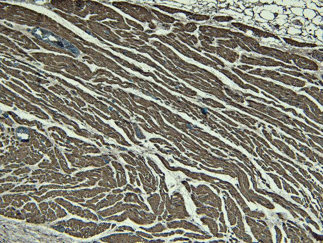 Nkx2.5 Antibody in Immunohistochemistry (Paraffin) (IHC (P))