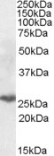 PSMB10 Antibody in Western Blot (WB)