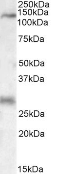 MEKK6 Antibody in Western Blot (WB)