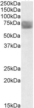 CLN2 Antibody in Western Blot (WB)