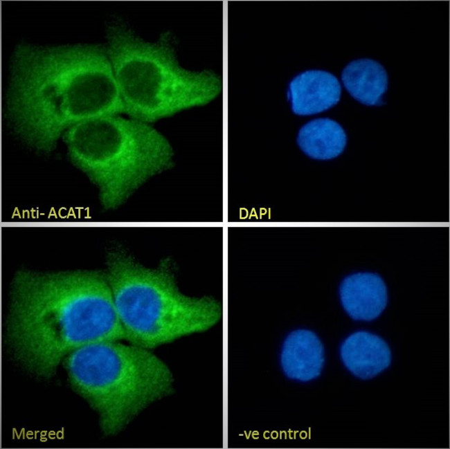 ACAT1 Antibody in Immunocytochemistry (ICC/IF)