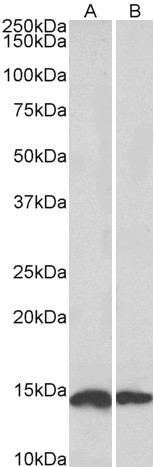 NDUFS6 Antibody in Western Blot (WB)