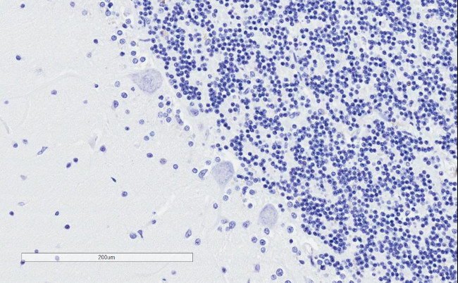 TPPP Antibody in Immunohistochemistry (Paraffin) (IHC (P))