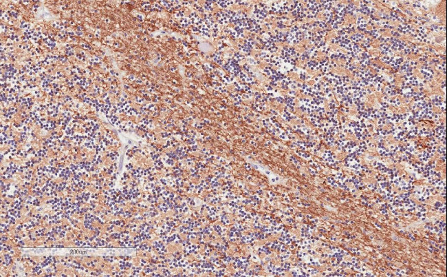 TPPP Antibody in Immunohistochemistry (Paraffin) (IHC (P))