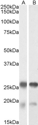 TPPP Antibody in Western Blot (WB)