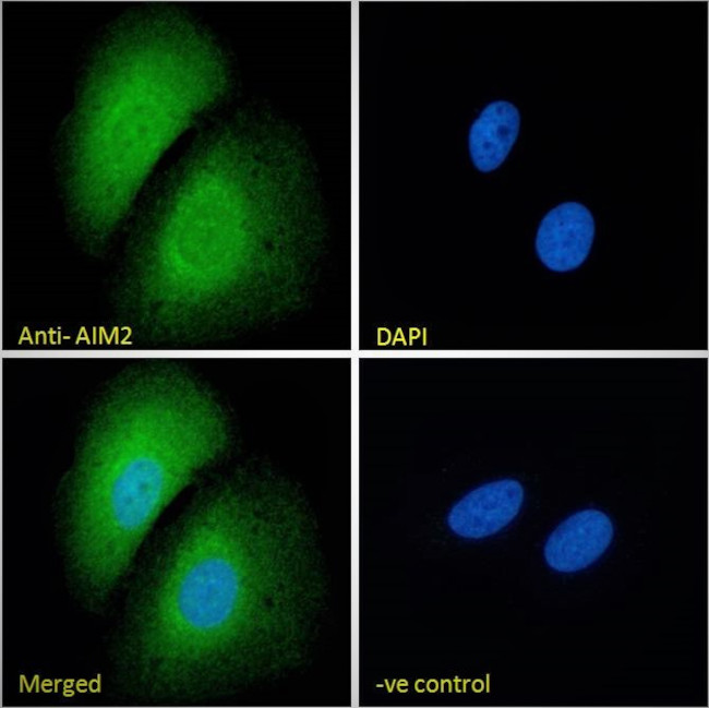 AIM2 Antibody in Immunocytochemistry (ICC/IF)