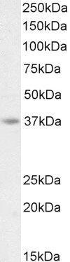 AIM2 Antibody in Western Blot (WB)