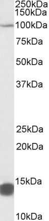 TRIM71 Antibody in Western Blot (WB)