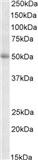 TRIP6 Antibody in Western Blot (WB)