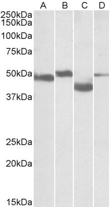 MEIS2 Antibody in Western Blot (WB)