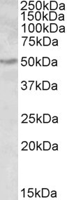 ALDH9A1 Antibody in Western Blot (WB)