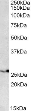 PSMB4 Antibody in Western Blot (WB)