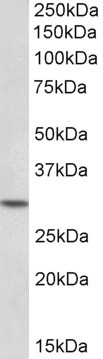 HOXC8 Antibody in Western Blot (WB)