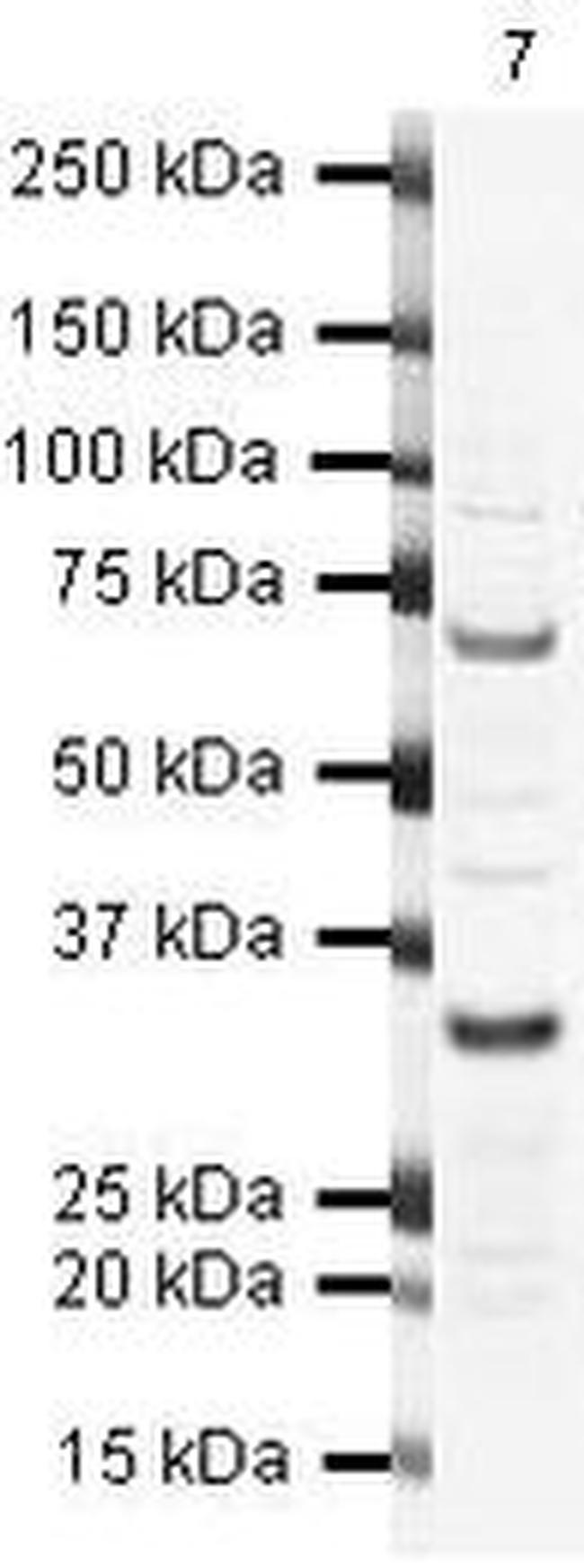 SKP1 Antibody in Western Blot (WB)