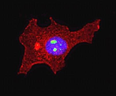 hnRNP K Antibody in Immunocytochemistry (ICC/IF)