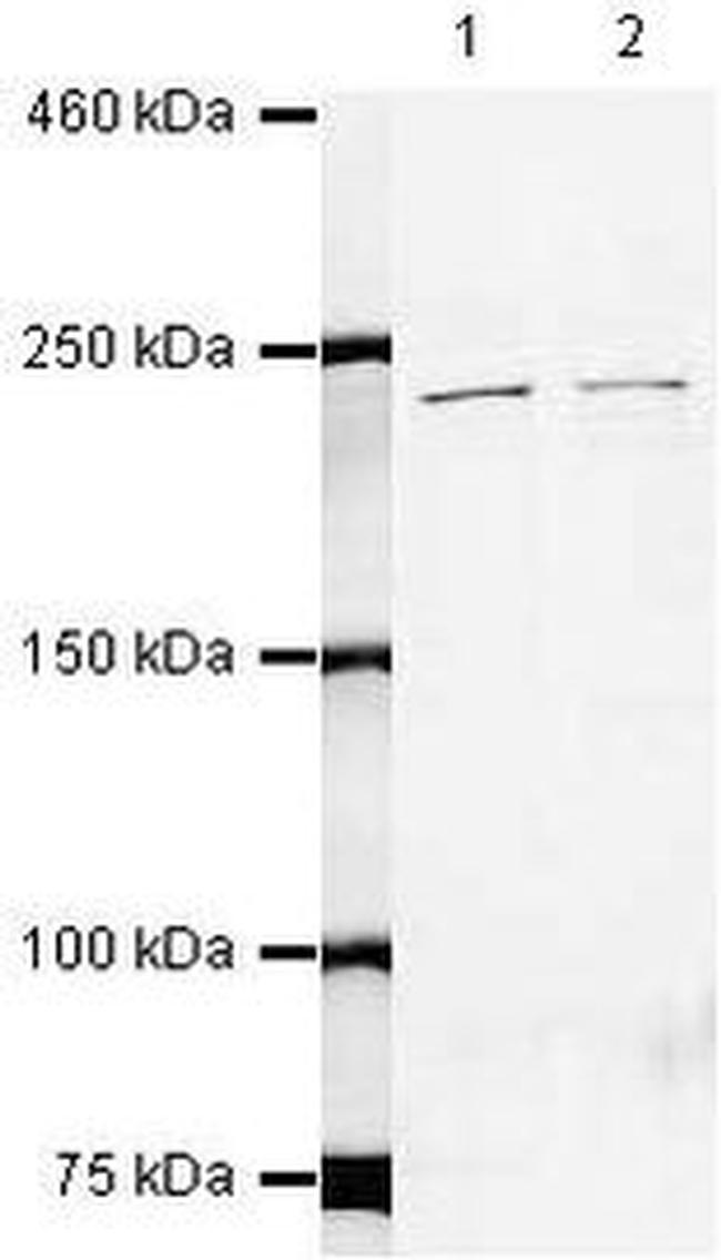 SPT6 Antibody in Western Blot (WB)