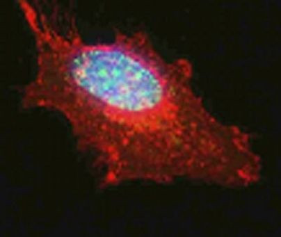 MNAR Antibody in Immunocytochemistry (ICC/IF)