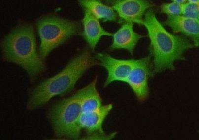 VE-cadherin Antibody in Immunocytochemistry (ICC/IF)