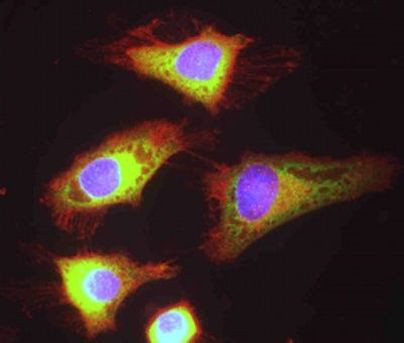 eIF4B Antibody in Immunocytochemistry (ICC/IF)