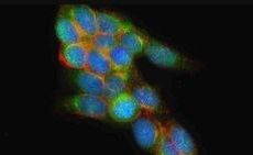 SNAP25 Antibody in Immunocytochemistry (ICC/IF)