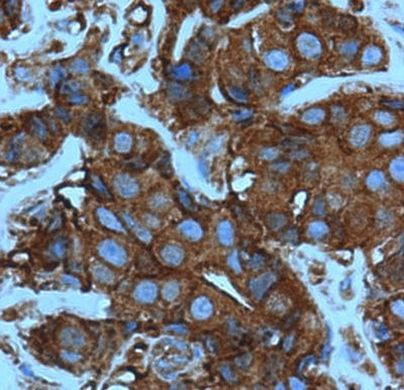 Cofilin Antibody in Immunohistochemistry (Paraffin) (IHC (P))