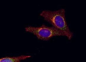 Galectin 8 Antibody in Immunocytochemistry (ICC/IF)