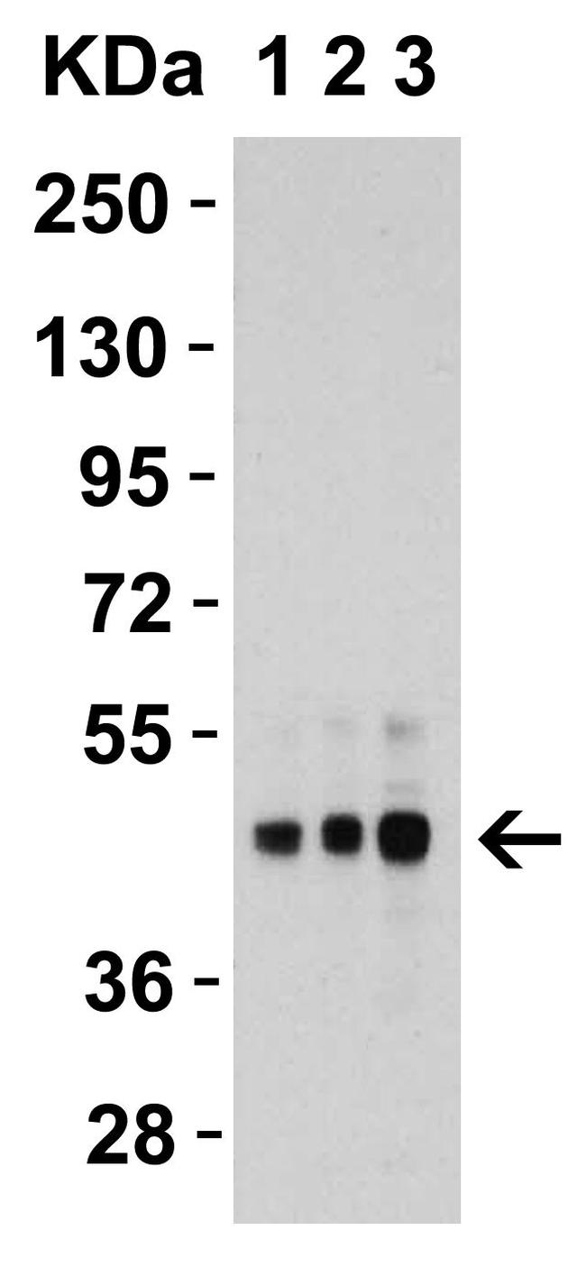 TRAIL-R2 (DR5) Antibody in Western Blot (WB)