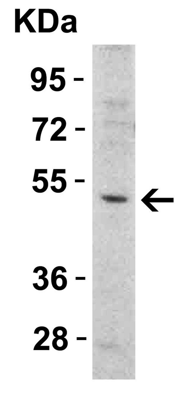 TRAIL-R2 (DR5) Antibody in Western Blot (WB)