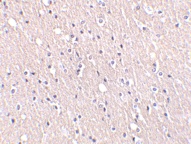 CIDEA Antibody in Immunohistochemistry (IHC)