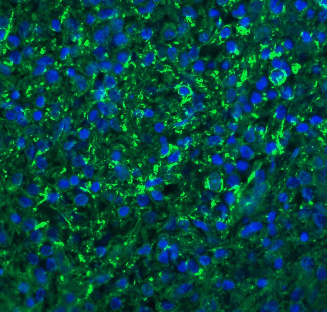 CXCR6 Antibody in Immunohistochemistry (IHC)