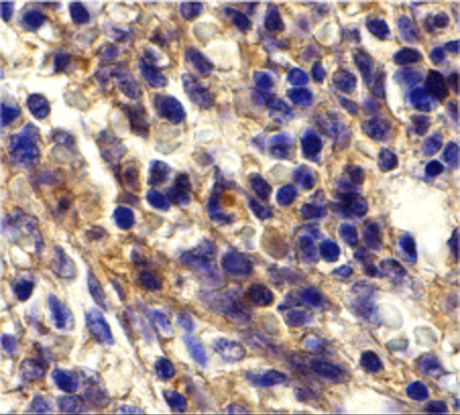 CXCR6 Antibody in Immunohistochemistry (IHC)