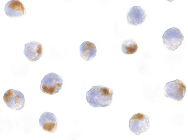 Acinus Antibody in Immunocytochemistry (ICC/IF)