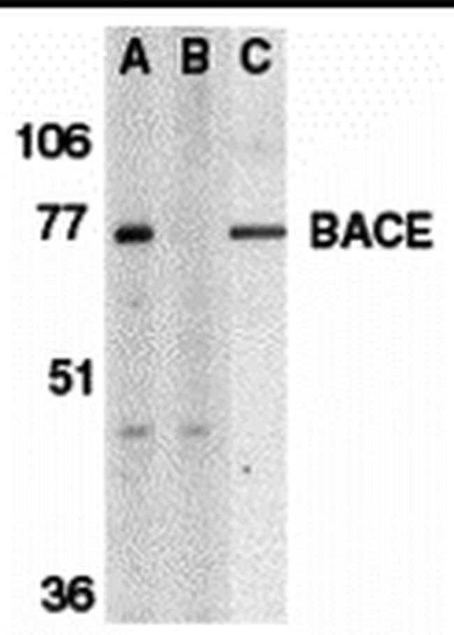 BACE1 Antibody in Western Blot (WB)