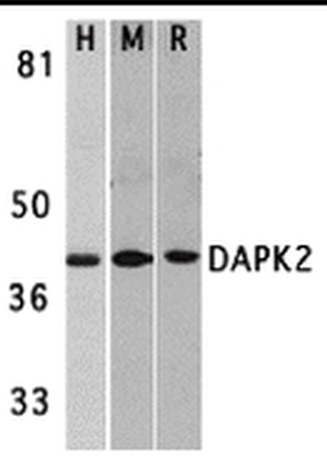DAPK2 Antibody in Western Blot (WB)