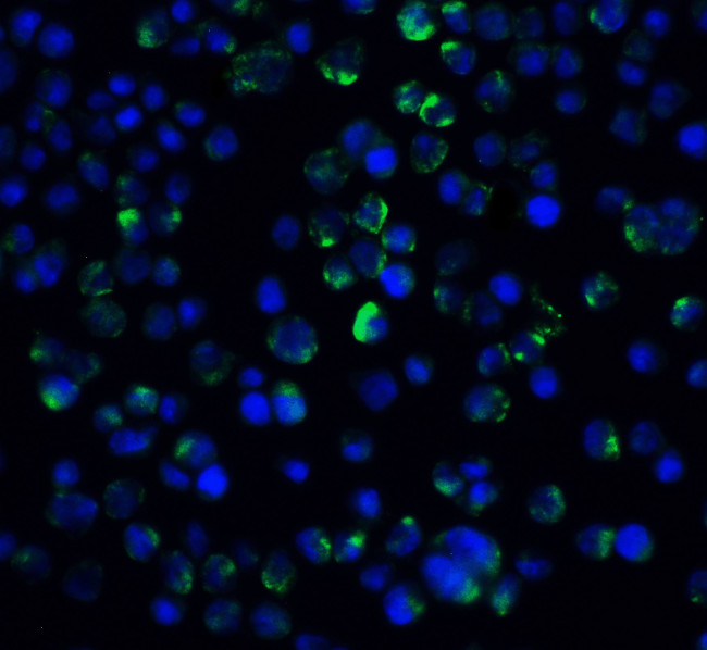 IL21R Antibody in Immunocytochemistry (ICC/IF)