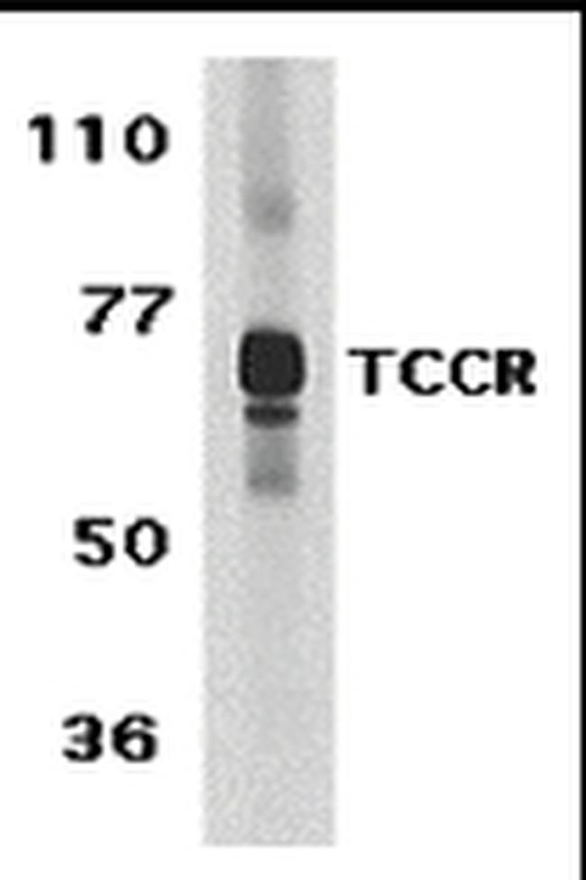 TCCR Antibody in Western Blot (WB)