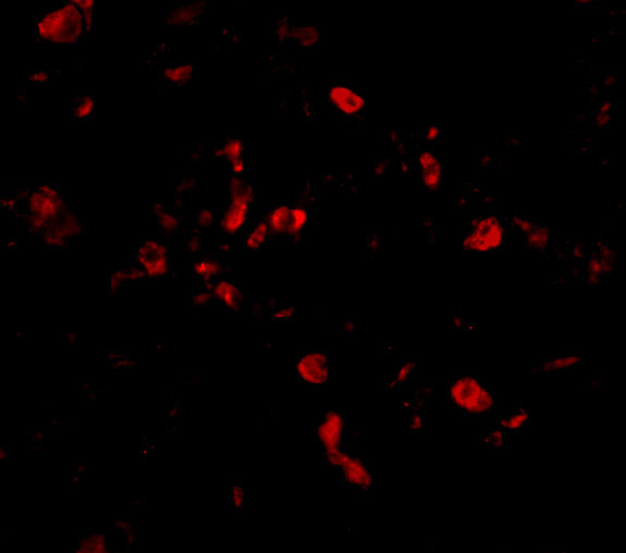 TRAF3IP2 Antibody in Immunocytochemistry (ICC/IF)