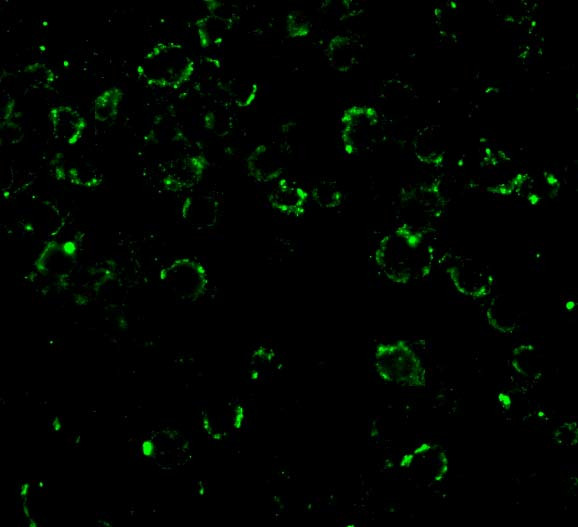 CARD10 Antibody in Immunocytochemistry (ICC/IF)