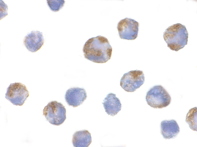 NALP1 Antibody in Immunocytochemistry (ICC/IF)