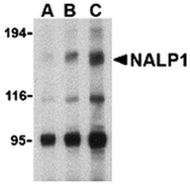 NALP1 Antibody in Western Blot (WB)
