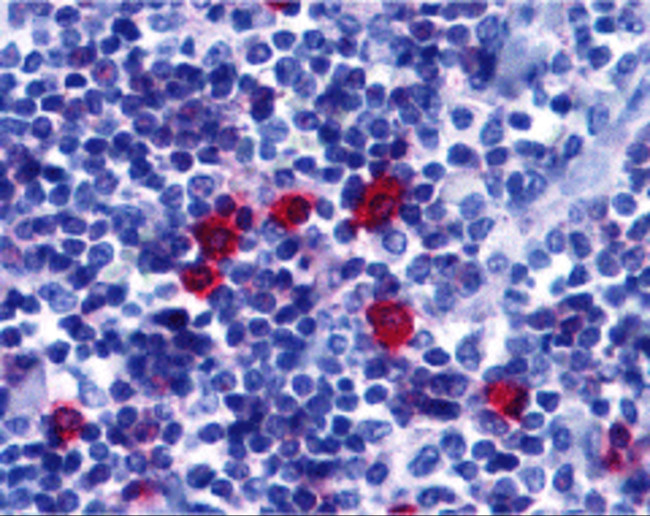 CD268 (BAFF Receptor) Antibody in Immunohistochemistry (IHC)