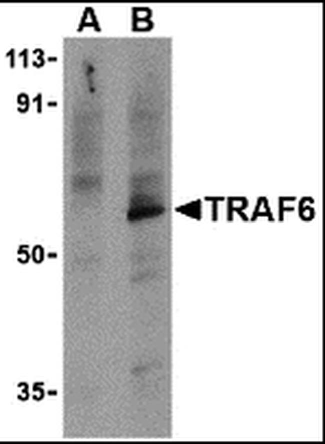 TRAF6 Antibody in Western Blot (WB)