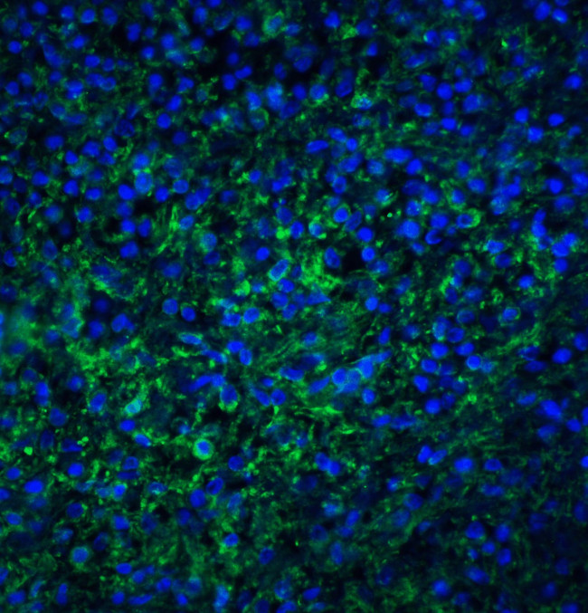 TLR4 Antibody in Immunohistochemistry (IHC)