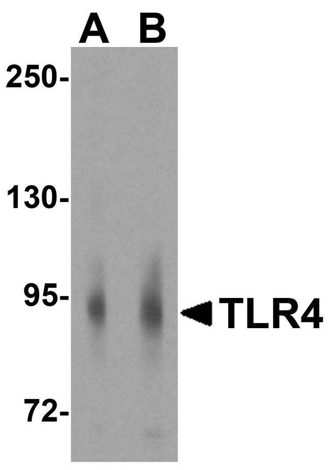 TLR4 Antibody in Western Blot (WB)