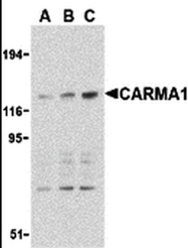 CARD11 Antibody in Western Blot (WB)